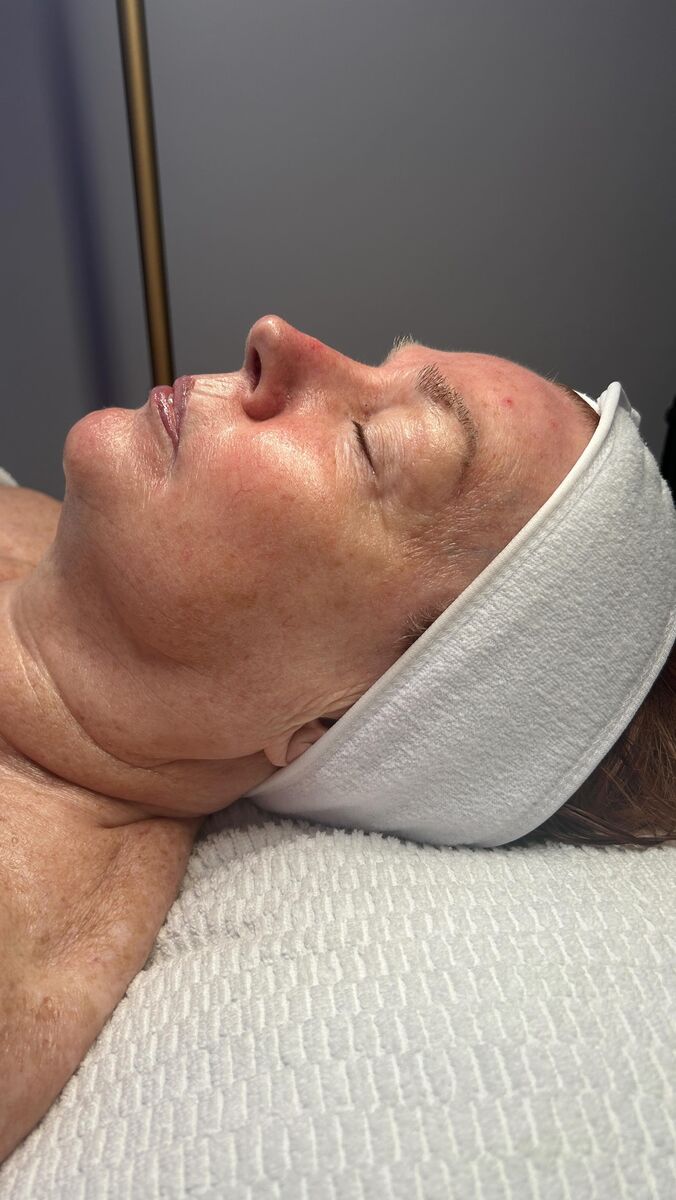 Skin consultation and facial at SKN Lab HQ, New Ferry, Wirral